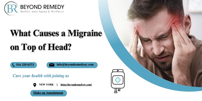 Migraine on Top of Head, Best Home Remedies or IV Treatments